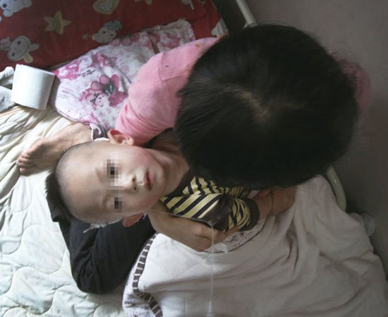 昆明两岁儿童做疝气手术脑萎缩医院称麻醉意外